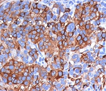 MLANA / Melan-A Antibody (clone A103, Ready-to-Use)