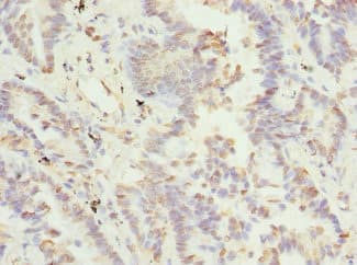 Polyclonal Rabbit anti-Human TSSK3 / STK22C Antibody (IHC)