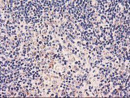 PDSS2 / DLP1 Antibody (clone OTI1D12)
