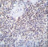 PATL2 Antibody (aa168-196)