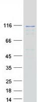 Human EFTUD2 Protein (Recombinant Myc-DDK (Flag))