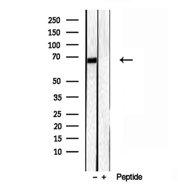 Polyclonal Rabbit anti-Human LMOD3 Antibody (IHC, WB)