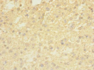 Polyclonal Rabbit anti-Human TMEM56 Antibody