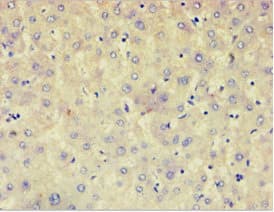 Polyclonal Rabbit anti-Human AFAP1 / AFAP Antibody (aa461-730, IHC)
