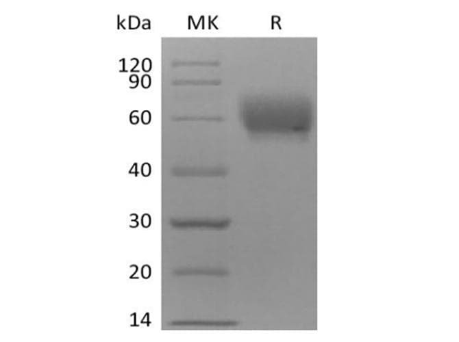 Cynomolgus TPBG / 5T4 Protein (Recombinant 6His, C-terminus)