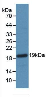 F2 / Prothrombin / Thrombin Antibody (aa44-200)