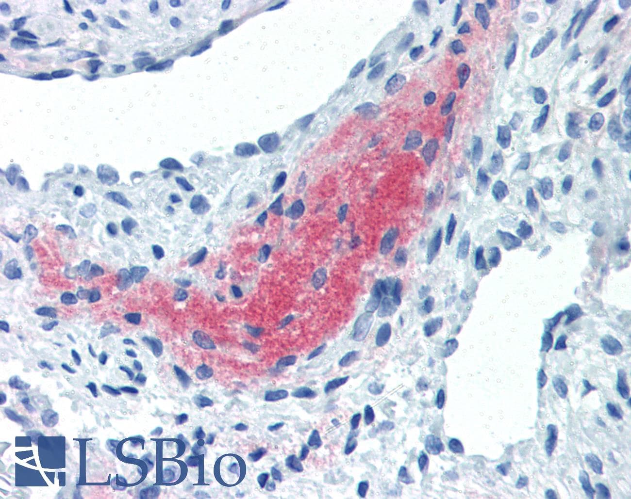 IHC-plus™ TGFB4 / LEFTY2 Antibody (clone 7C5G1H6H10)