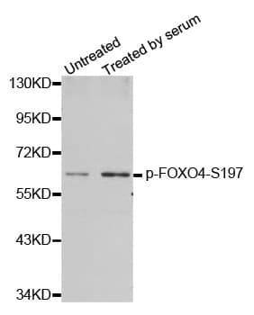 Polyclonal Rabbit anti-Human FOXO4 / AFX1 Antibody (phospho-Ser197, IHC, IF, WB)