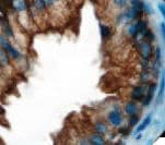 KRT8 / CK8 / Cytokeratin 8 Antibody (clone 35βH11)