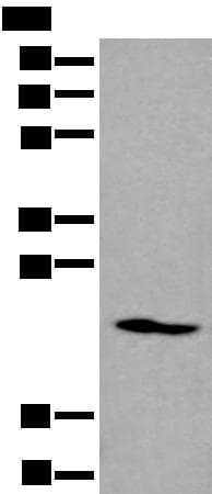 Polyclonal Rabbit anti-Human ARL1 Antibody (IHC, WB)