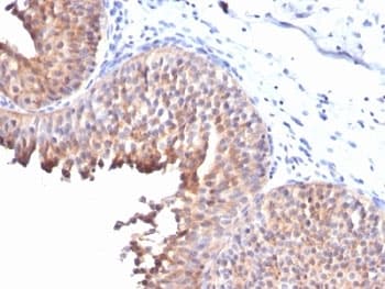 KRT10 / CK10 / Cytokeratin 10 Antibody (clone KRT10/844)