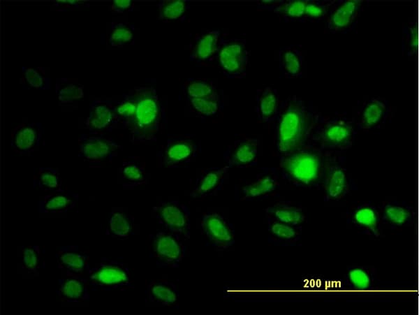 AURKA / Aurora-A Antibody (aa1-111, clone 5F8)