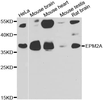 EPM2A / Laforin Antibody