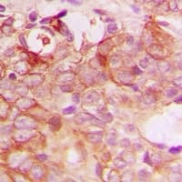 TP53I3 / PIG3 Antibody (C-Terminus)