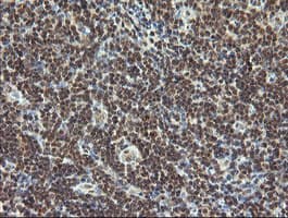 ESRRG / ERR Gamma Antibody (clone OTI6G1)
