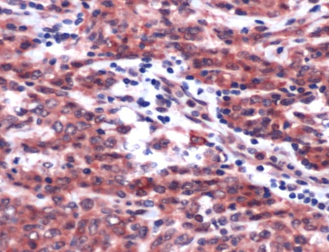 PDGFRB / PDGFR Beta Antibody (C-Terminus)