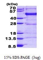 Human FBLIM1 / Migfilin Protein (Recombinant His)