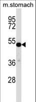 Polyclonal Rabbit anti-Human CRTR1 / TFCP2L1 Antibody (aa222-251, IHC, WB)