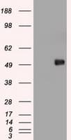 MYC / c-Myc Antibody (clone OTI5G3)