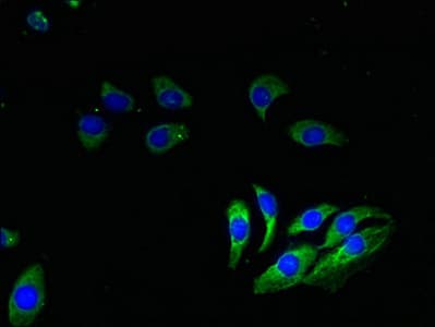 IHC-plus™ Polyclonal Rabbit anti-Human COXG / COX6B1 Antibody (IHC, WB)