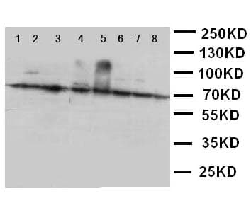 XRCC6 / Ku70 Antibody (aa530-545)
