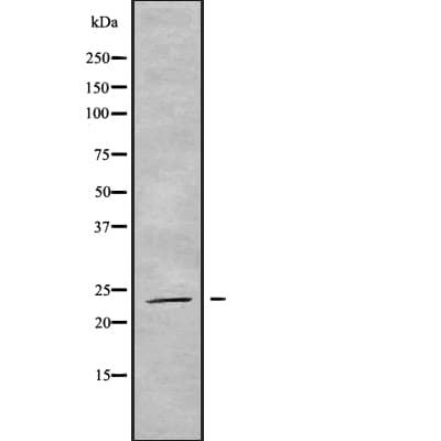 Polyclonal Rabbit anti-Human RAB19 Antibody (WB)