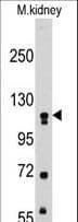 MUSK Antibody (aa70-366)