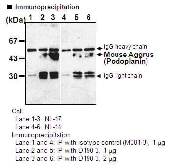 PDPN / Podoplanin Antibody (clone 8F11)