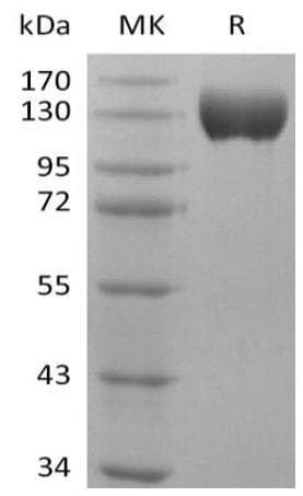 Human ACE2 / ACE-2 Protein (Recombinant Fc, C-terminus)