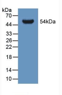 GLTP Antibody (aa2-209, PE)