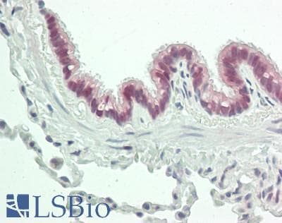 XCL1 / Lymphotactin Antibody (aa27-107)