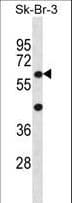 STXBP3 Antibody (aa145-171)
