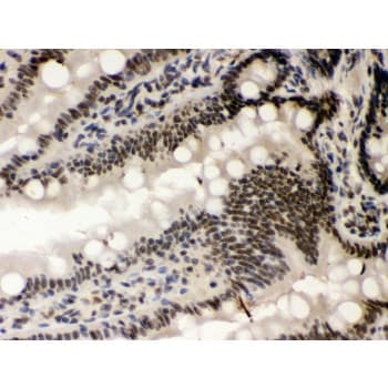 CSNK1A1 / CK1 Alpha Antibody (aa30-68)