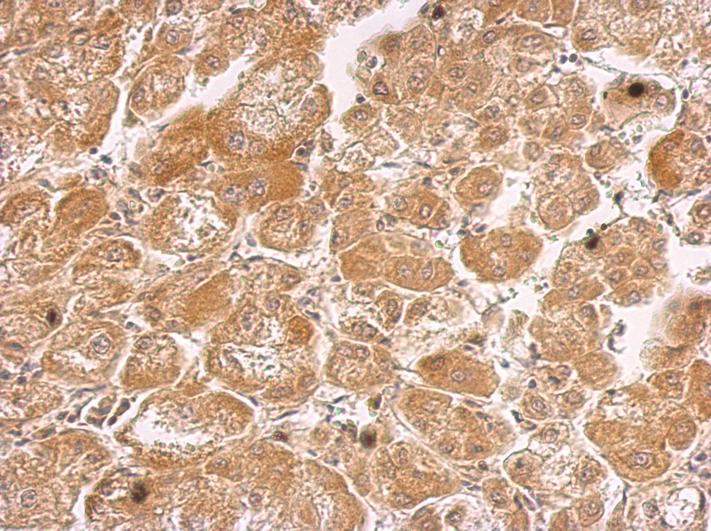 Polyclonal Rabbit anti-Human HHIP / HIP Antibody (aa263-554, IHC, WB)