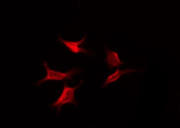 GPR173 / SREB3 Antibody