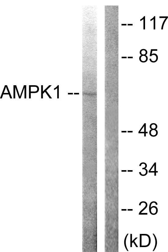 PRKAA1 / AMPK Alpha 1 Antibody (p172)