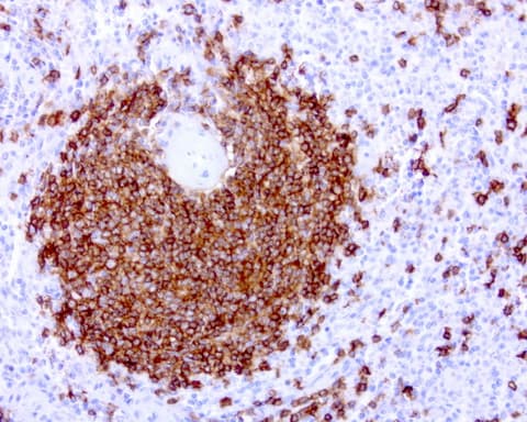 CD20 Antibody (clone UMAB37)