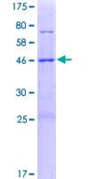 Human METTL7B Protein (Recombinant GST)