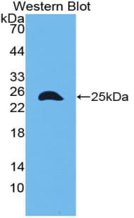 TLN1 / Talin 1 Antibody (aa975-1181, FITC)