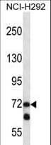 Polyclonal Rabbit anti-Human LOXL3 Antibody (aa715-744, IHC, WB)