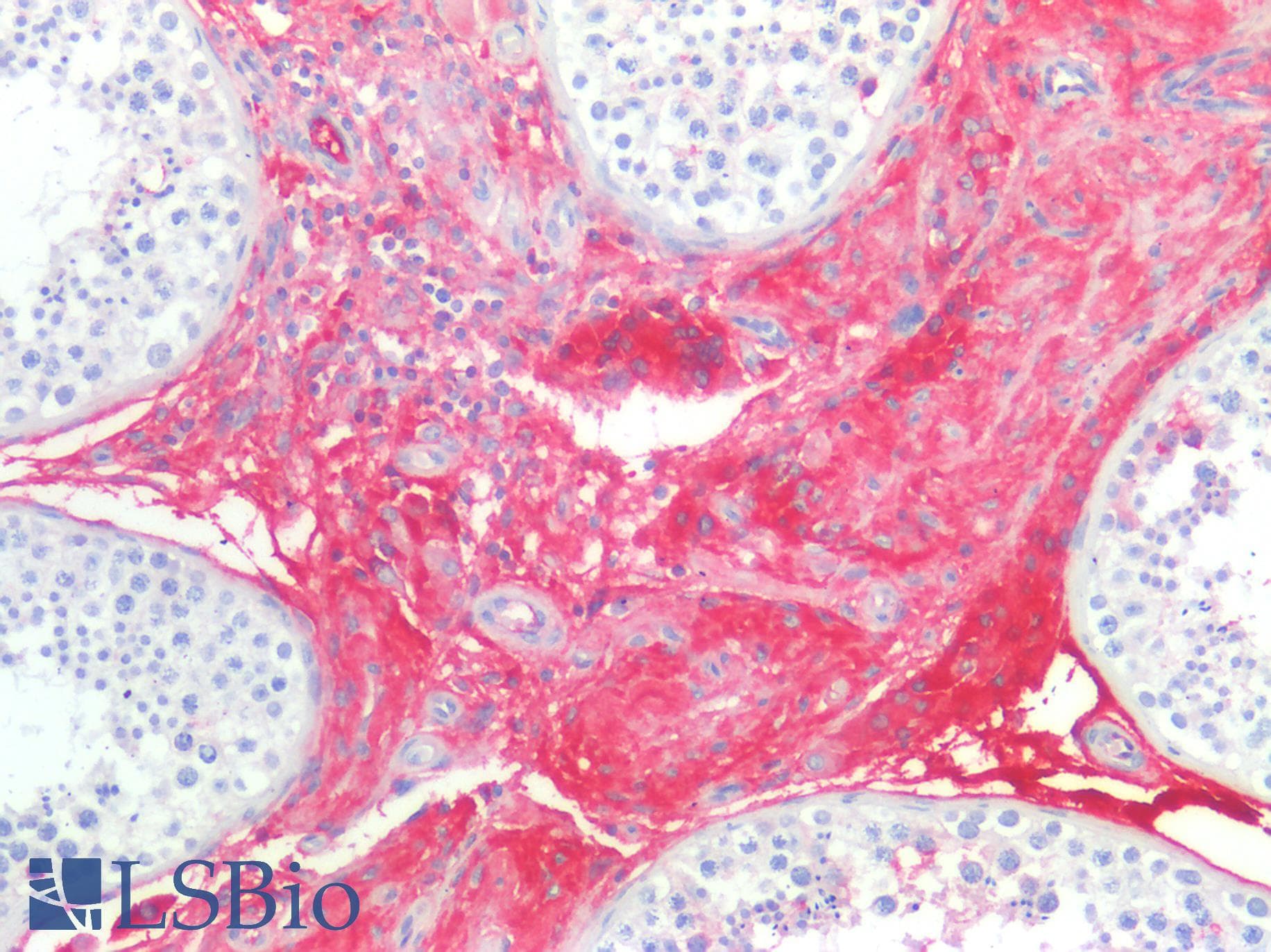 PathPlus™ Polyclonal Rabbit anti-Human SERPINA1 / Alpha 1 Antitrypsin Antibody (C-Terminus, IHC, WB)