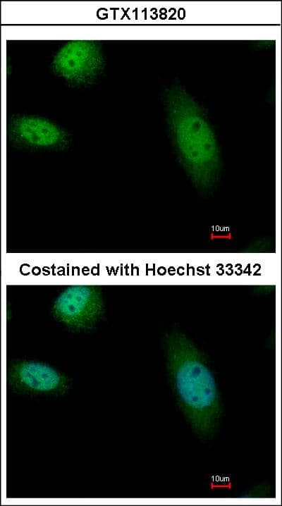 Polyclonal Rabbit anti-Human RAD23B / HR23B Antibody (IHC, IF, WB)