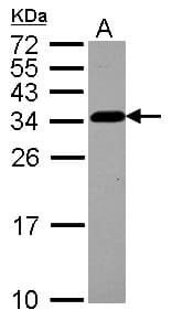 TBCB / CKAP1 Antibody