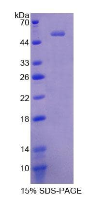 Human CTRB2 / Chymotrypsinogen B2 Protein (Recombinant His-GST)