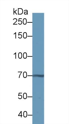 TKT / Transketolase Antibody (aa1-294)