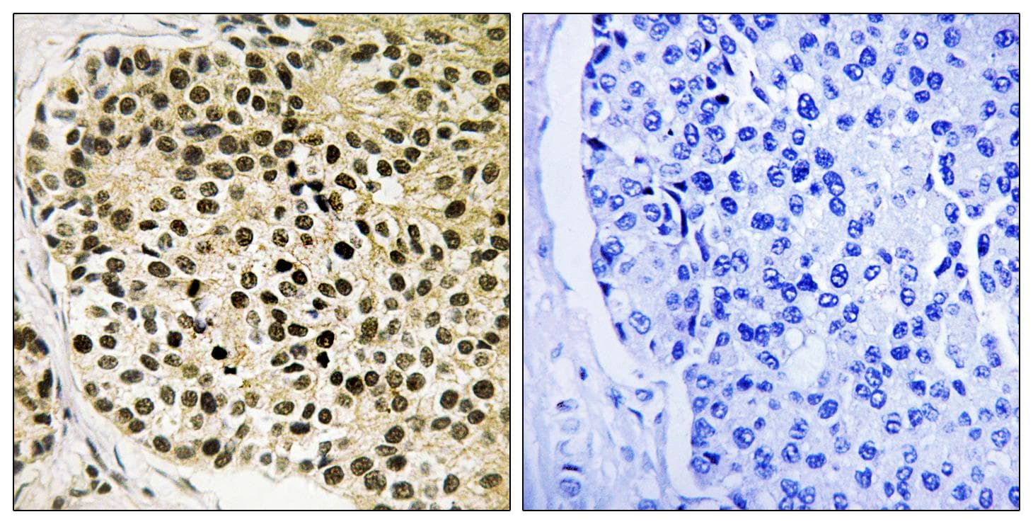 NFATC4 / NFAT3 Antibody (phospho-Ser168+Ser170)