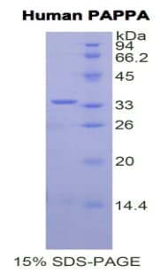 Human PAPPA / PAPP-A Protein (Recombinant His)