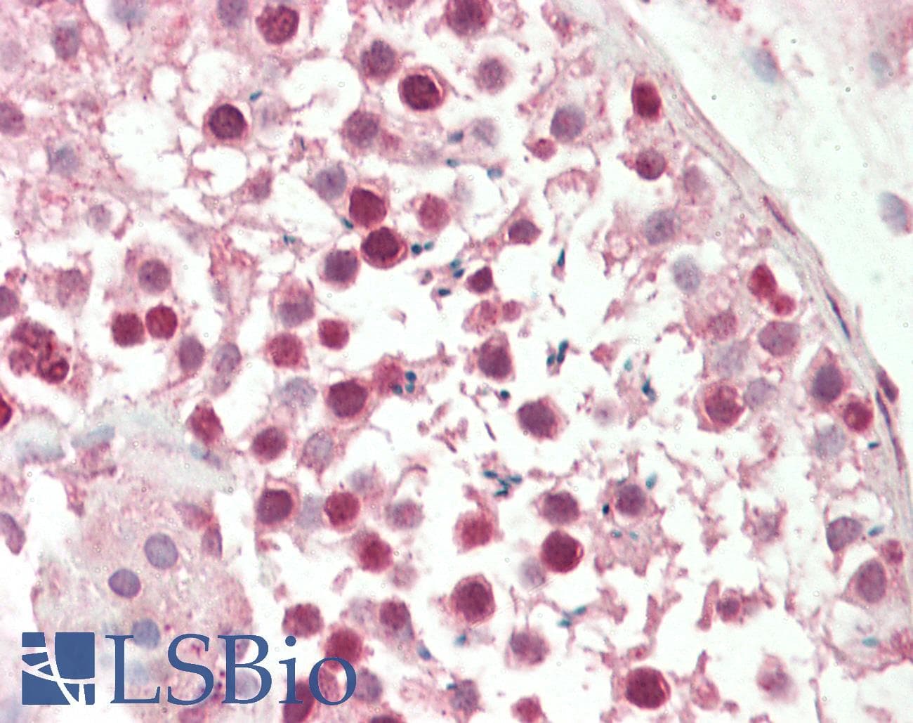 Polyclonal Rabbit anti-Human NFATC4 / NFAT3 Antibody (N-Terminus, IHC, WB)