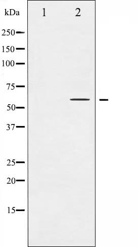 TH / Tyrosine Hydroxylase Antibody (phospho-Ser31)