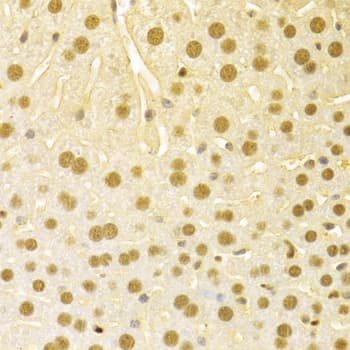 SFN / Stratifin / 14-3-3 Sigma Antibody